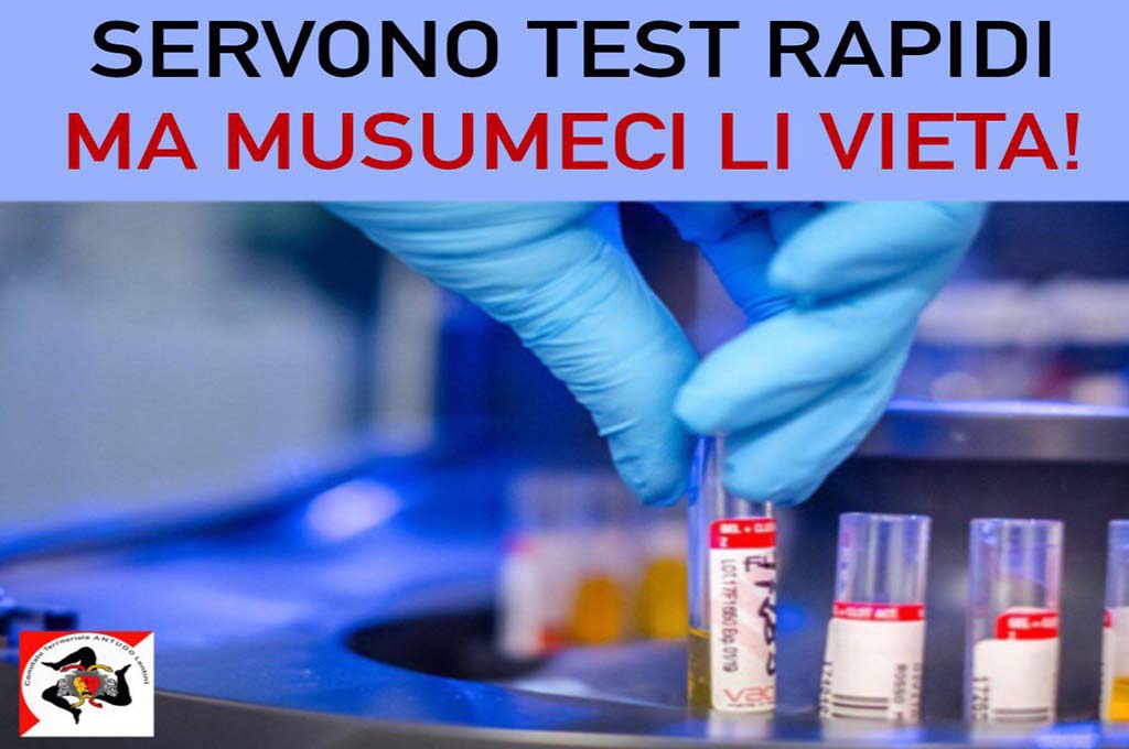 Covid-19: servono test rapidi, ma Musumeci li vieta